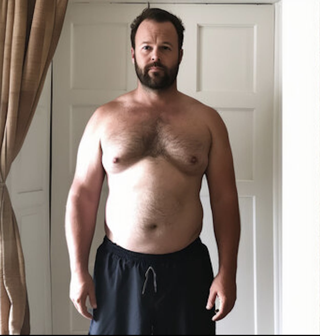Tom P., 44 - Before
